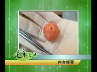 �����ӳ�20170413